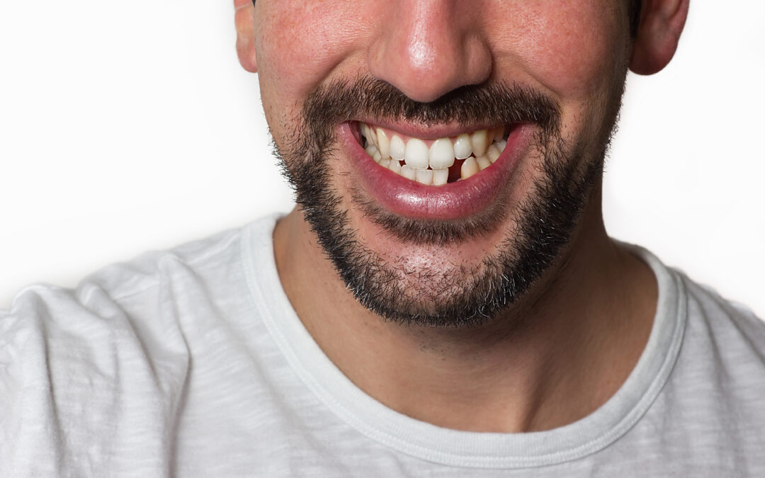 Emergency Cosmetic Dentistry: Your Smile’s Superhero in Boca Raton